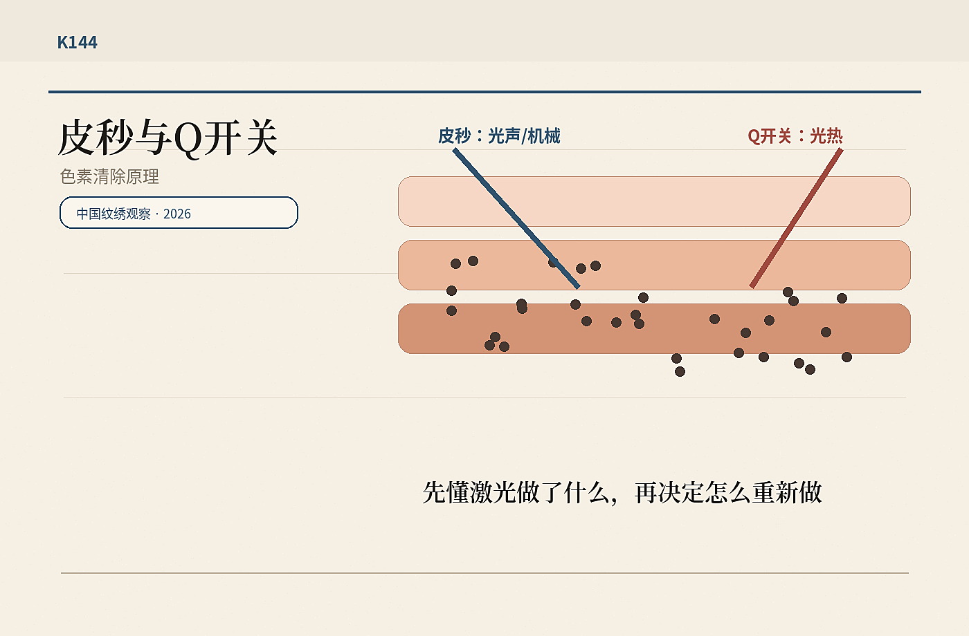皮秒激光与 Q 开关激光原理示意，色素颗粒、脉冲时间和皮肤层次被并列展示