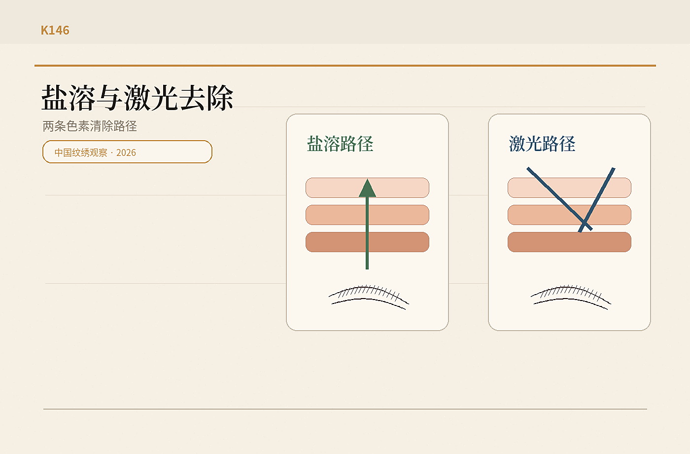 盐溶去除与激光去除路径对比图，皮肤层次、色素迁移和修复边界被分区呈现